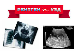Де зробити УЗД або рентген безоплатно?
