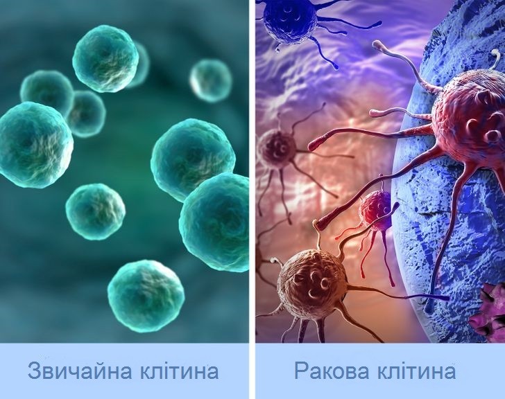 Діагностика та лікування раку - у центрі уваги Національної служби здоров’я
