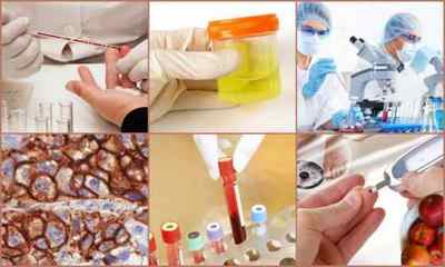 Безоплатні лаборатораторні та інструментальні дослідження у Програмі медичних гарантій