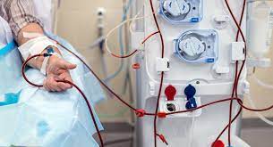 З 1 липня буде впроваджено новий пакет медичних послуг для пацієнтів з хронічною нирковою недостатністю